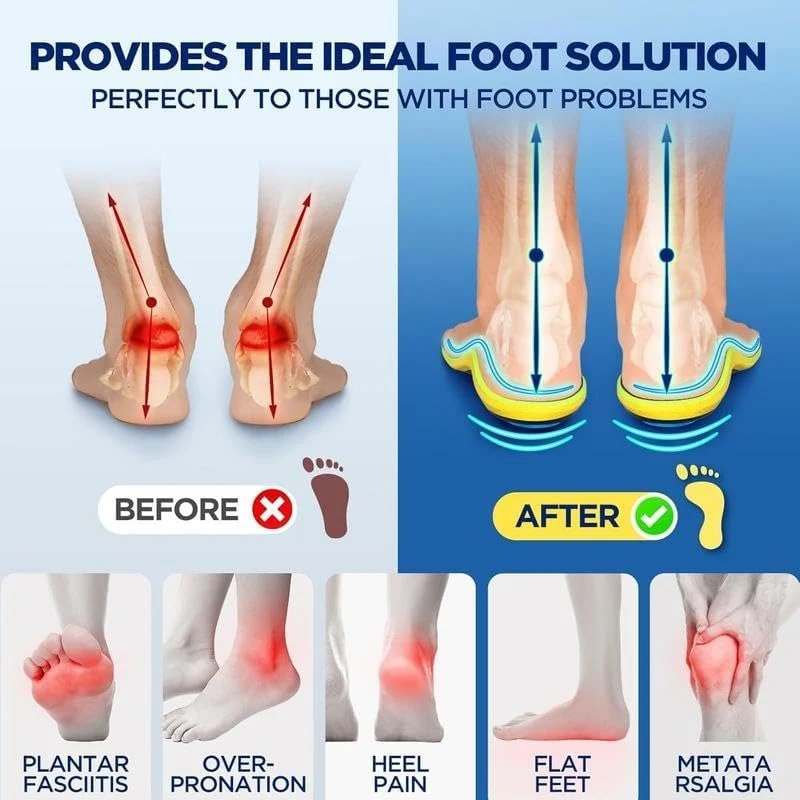 Magnetic Relief Insoles - Image 6